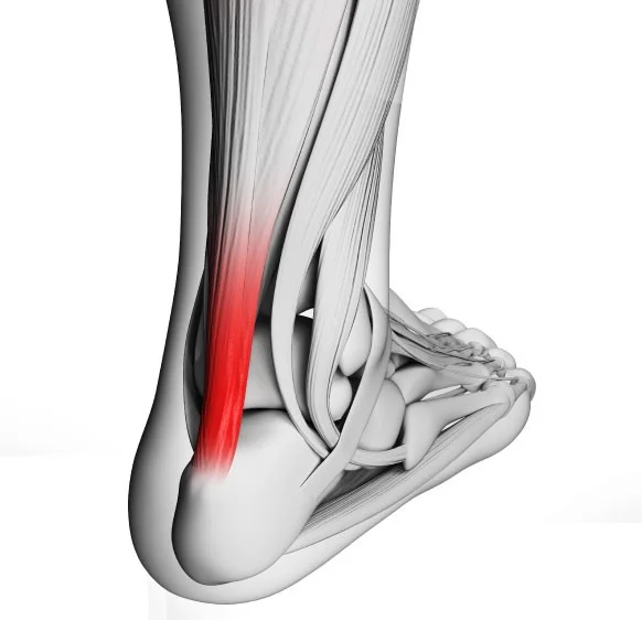 Achilles tendon deals pain